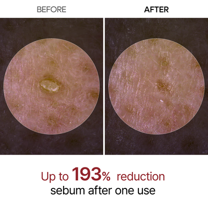 Black Rice Glow Ampoule | Pore-Refining Treatment