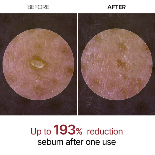 Black Rice Glow Ampoule | Pore-Refining Treatment
