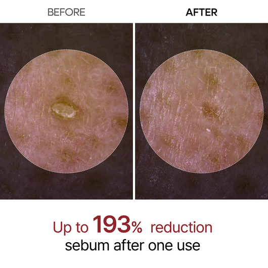 Black Rice Glow Ampoule | Pore-Refining Treatment