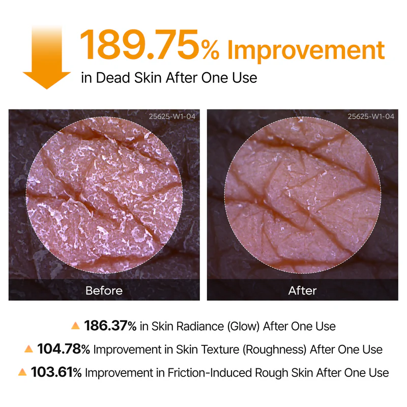 Peel Shot Keratin Care Kojic Acid Turmeric Spray