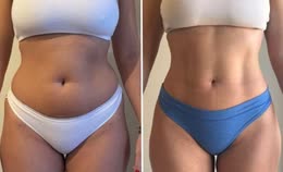 ReFirm result — Elena M.