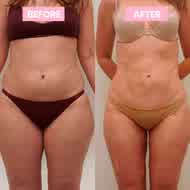 ReFirm result — Sofia R.
