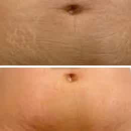 ReFirm result — Angie V.